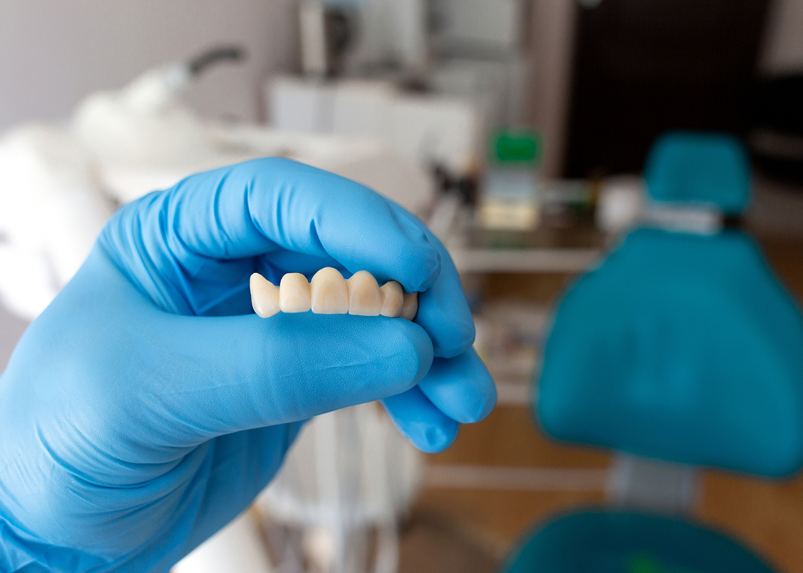 Dental bridge benefits and options at Press and Berman Clifton NJ