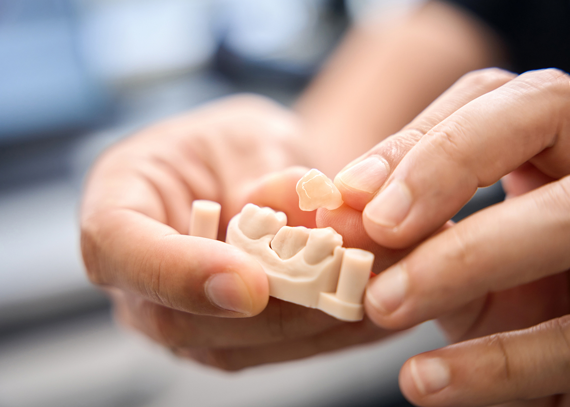 Long-lasting dental crowns at Press and Berman Clifton NJ