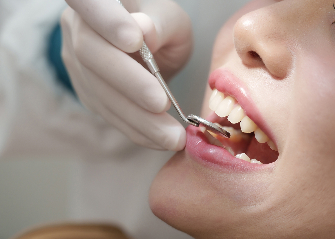 Professional dental cleaning at Press and Berman Clifton NJ
