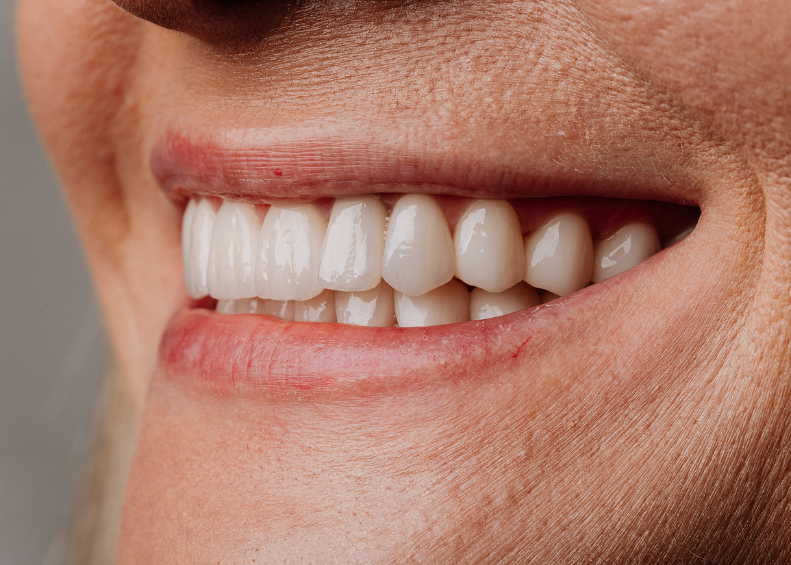 Periodontal health and dental implants Clifton NJ