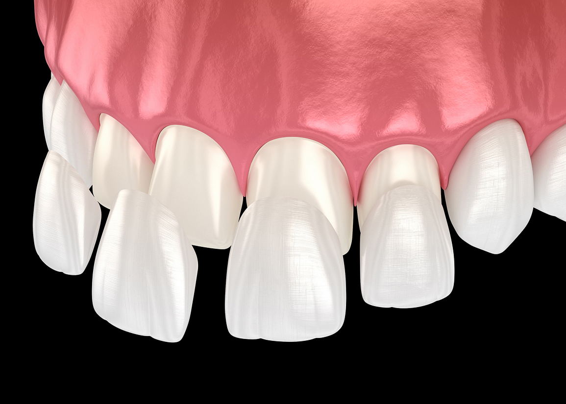 Cosmetic smile consultation at Press and Berman Clifton NJ
