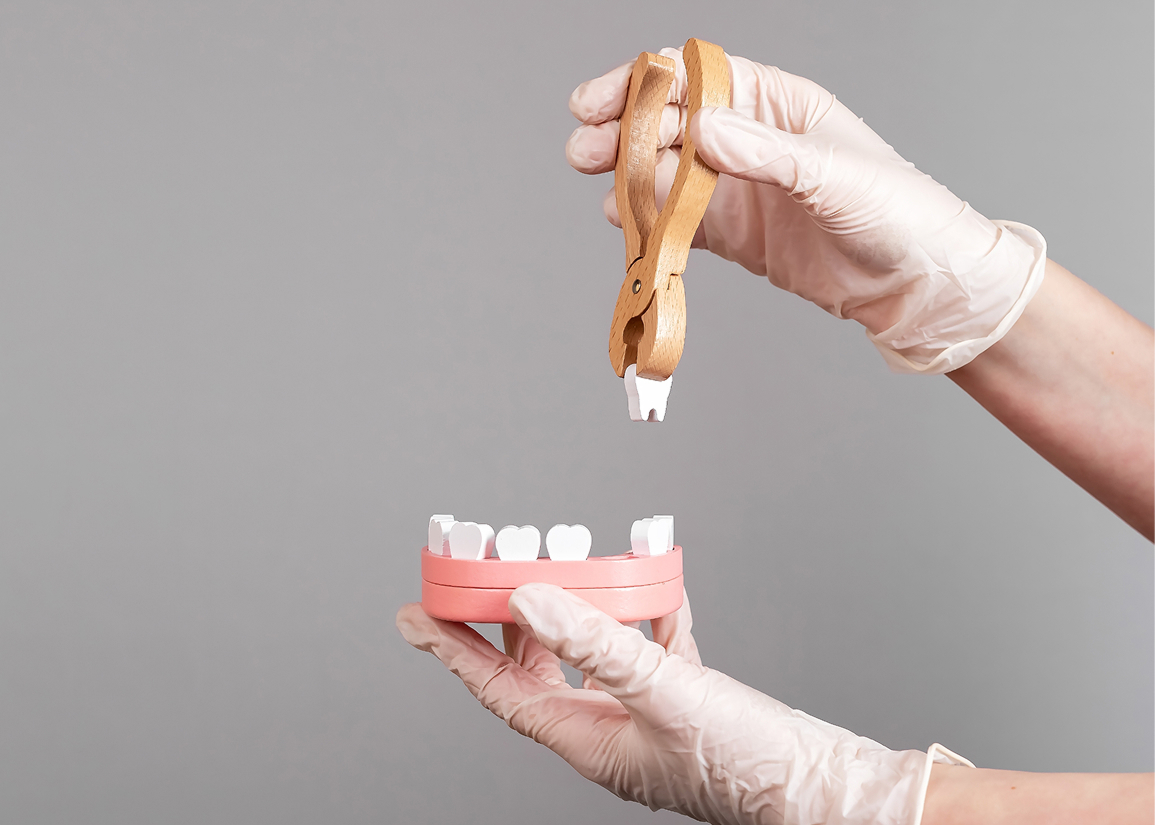 Tooth extraction aftercare at Press and Berman Clifton NJ